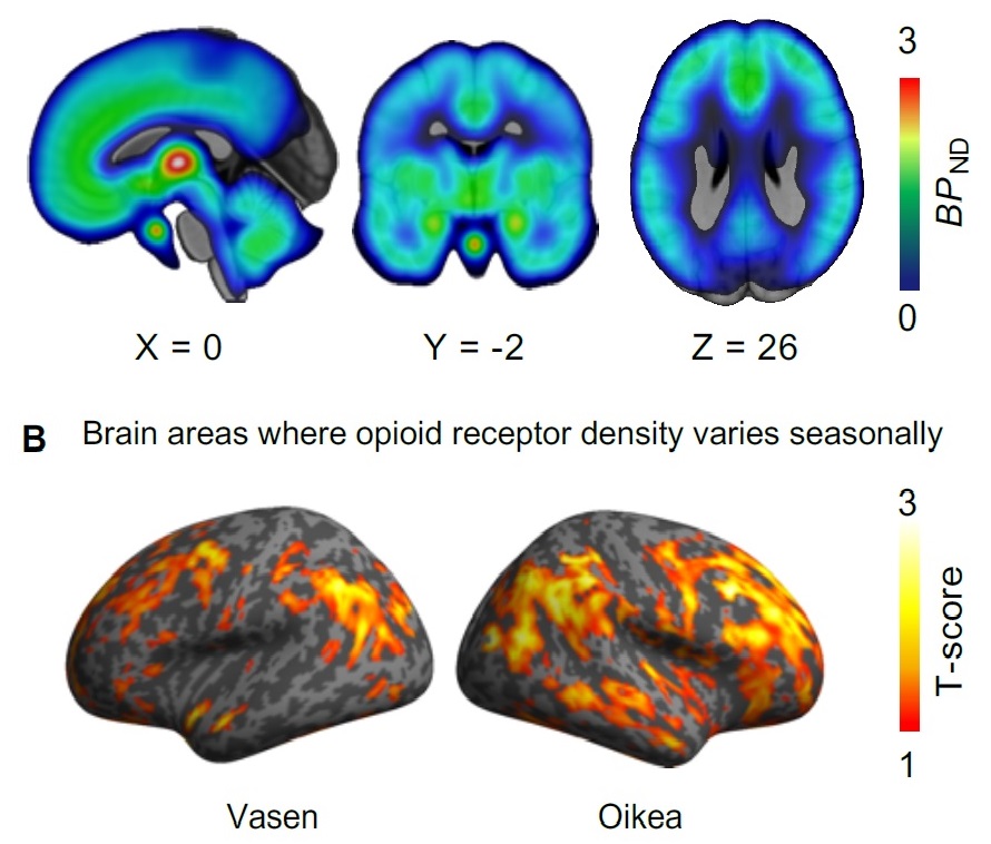 brain-seasonal-variation_1.jpg